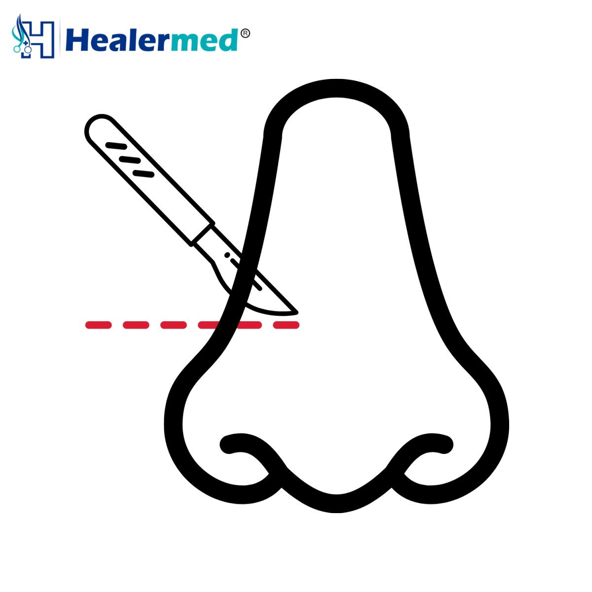 Nasal & Sinus Surgery Instruments