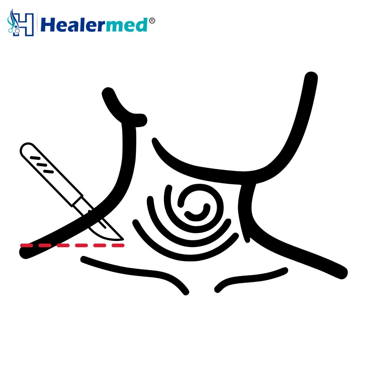 Laryngeal & Throat Instruments